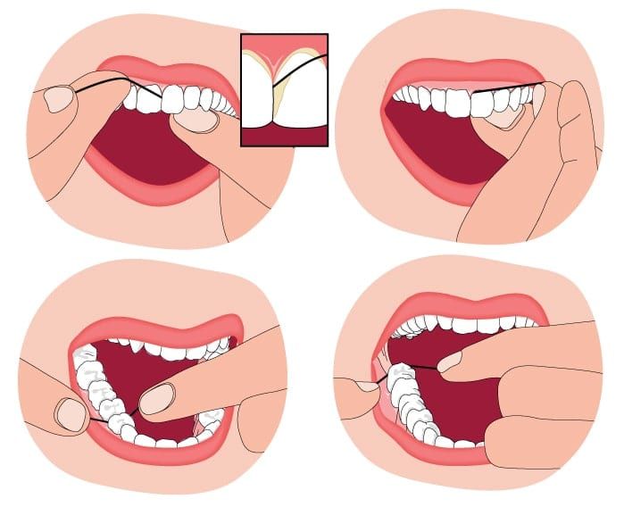 how to floss diagram