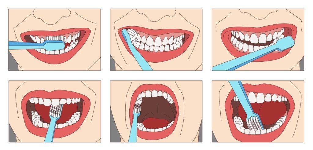 how to brush your teeth diagram