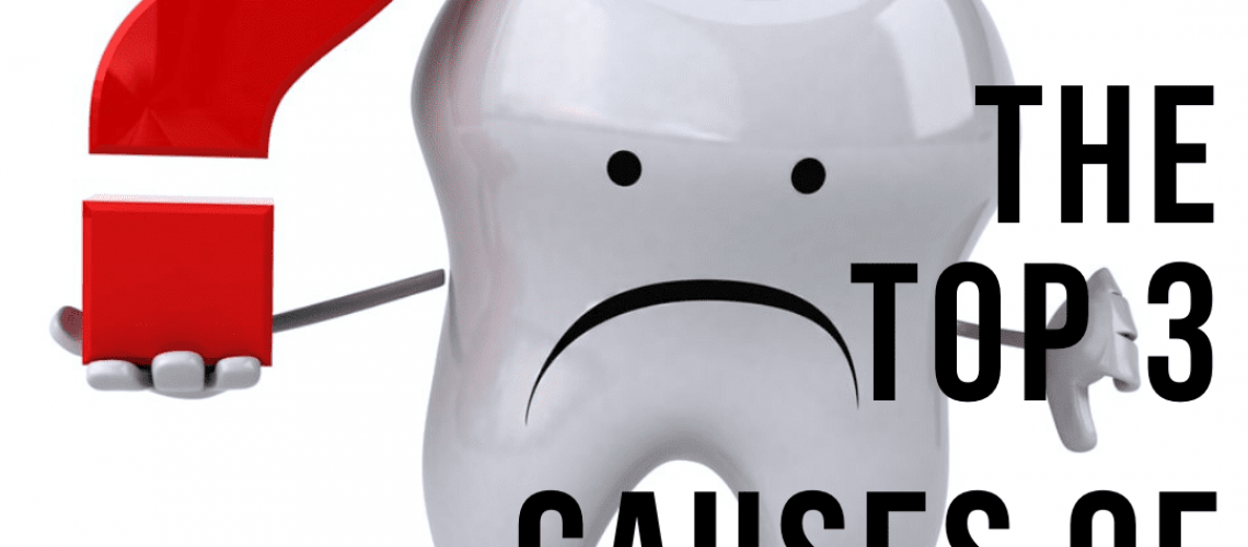 The Top 3 Causes of Cavities